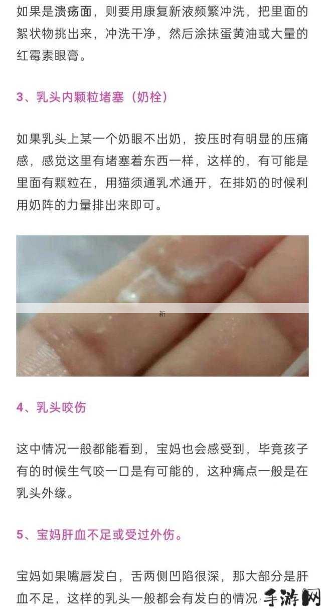 母乳喂养难题：宝宝乳头疼痛的深层原因探析